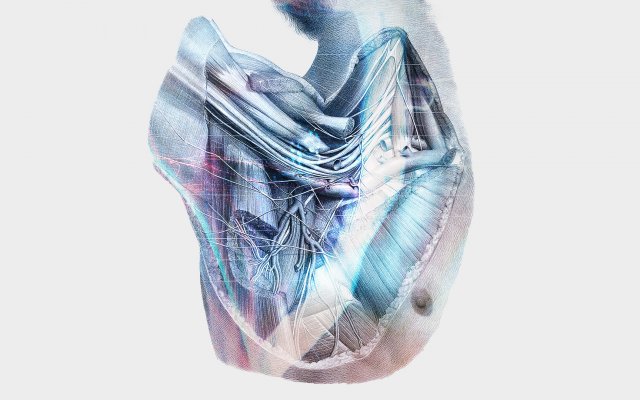 A solution to detect a brachial plexus on an ultrasound image