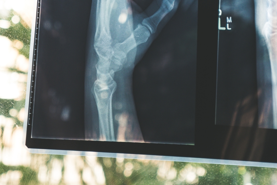 System for annotating X-ray images and generating pathologies